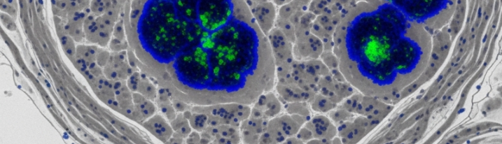 CUANTIFICACIÓN DE NANOPARTÍCULAS MAGNÉTICAS EN TEJIDOS